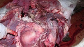 Tuberculosis