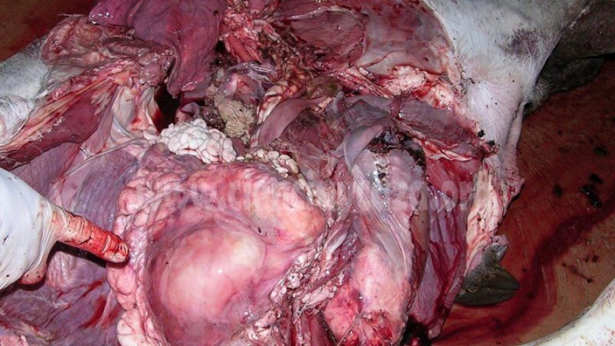 Tuberculosis